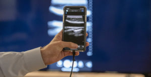 Scopri di più sull'articolo Un ecografo portatile, un iPhone e l’intelligenza artificiale salveranno milioni di vite