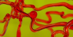 Scopri di più sull'articolo Il filo robotico che si fa strada nel cervello con un magnete: curerà ictus e aneurismi