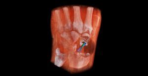 Scopri di più sull'articolo Radiografie a colori, in 3D e ora lo scanner è anche portatile