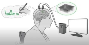 Scopri di più sull'articolo Scrivere un testo al PC immaginando di scriverlo su carta: ci è riuscito un utente paralizzato