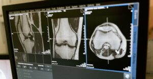 Scopri di più sull'articolo M2Test, la startup italiana che aiuta a diagnosticare in tempo l’osteoporosi. Come funziona il BES Test