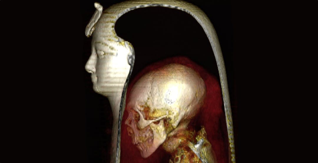 Scopri di più sull'articolo La mummia del faraone egiziano Amenhotep I è stata sbendata digitalmente
