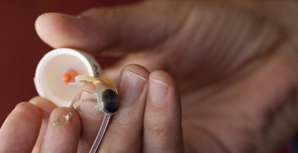 Avevano ricevuto un occhio bionico per tornare a vedere. Ora quell'occhio non è più supportato