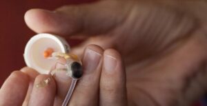 Scopri di più sull'articolo Avevano ricevuto un occhio bionico per tornare a vedere. Ora quell’occhio non è più supportato